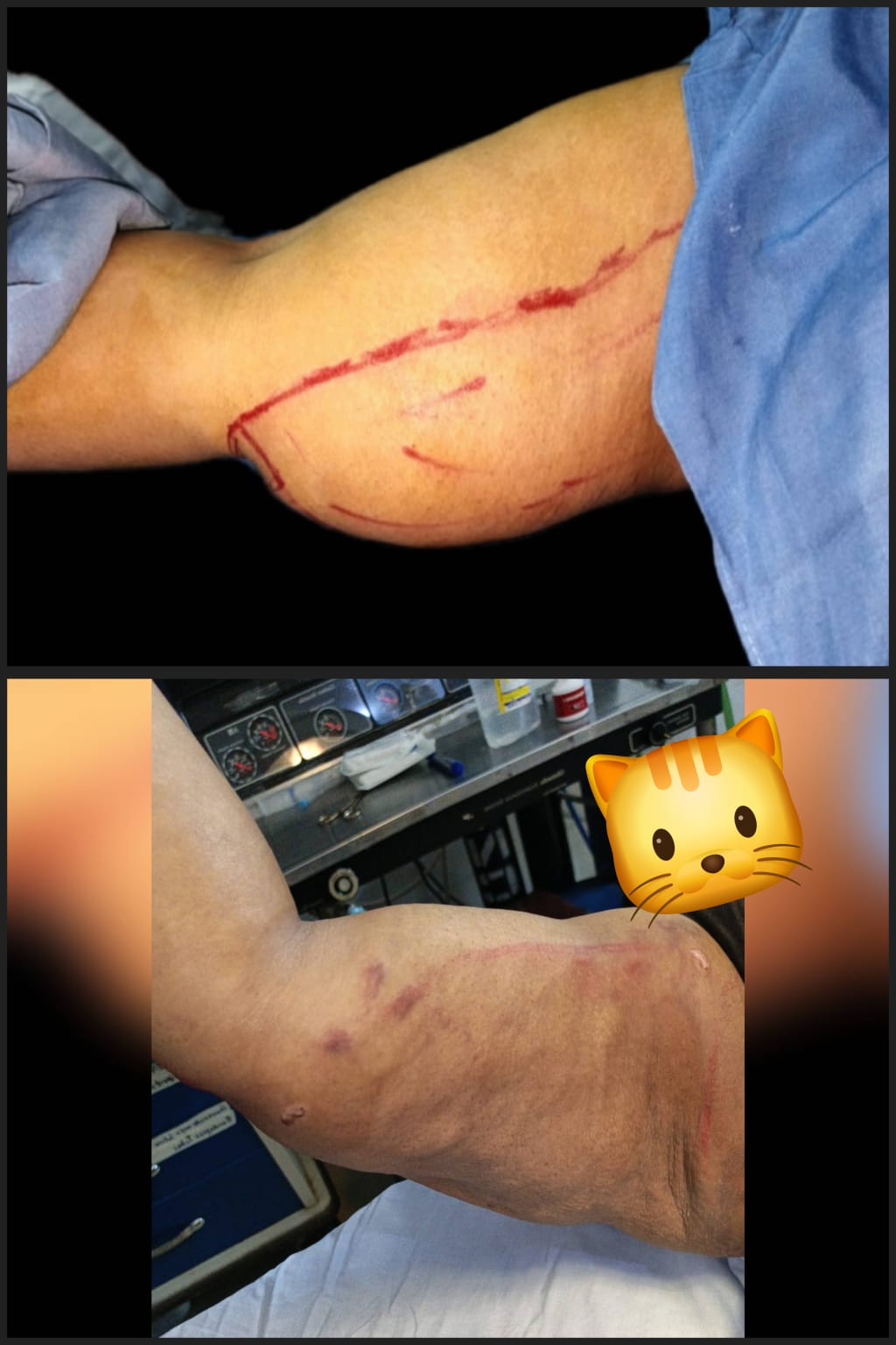 Before & After 66